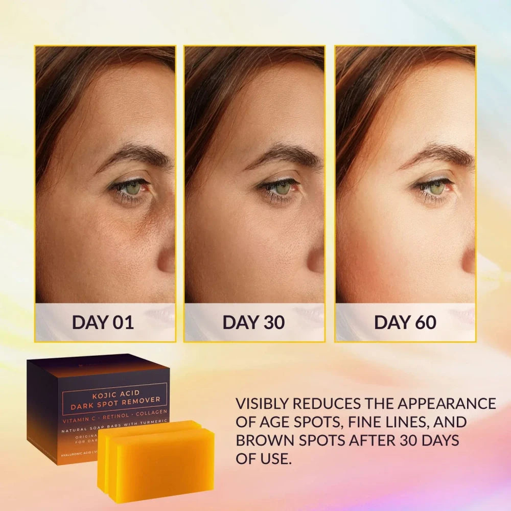 Kojic Acid Brightening Facial Soap